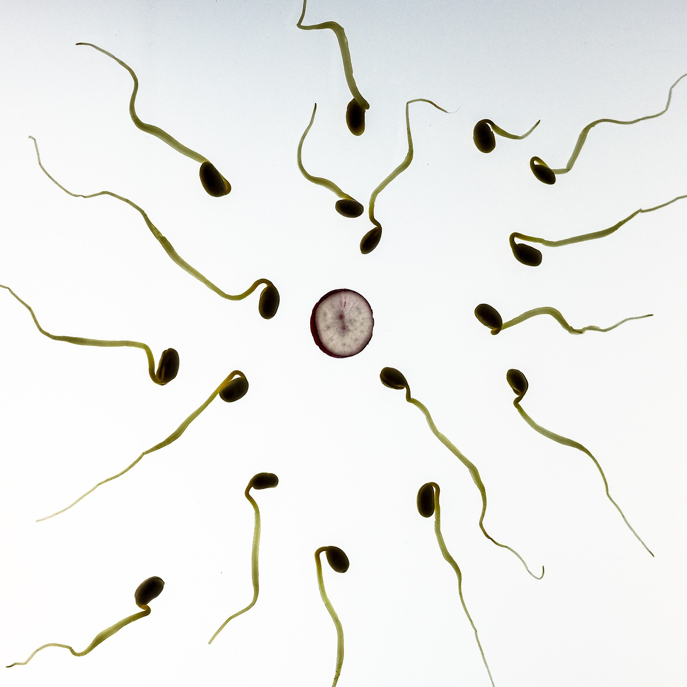 Spermien (Image by TBIT (CC0 Public Domain)via Pixabay)